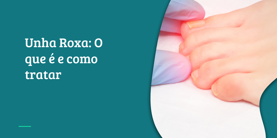 unha roxa stiletto