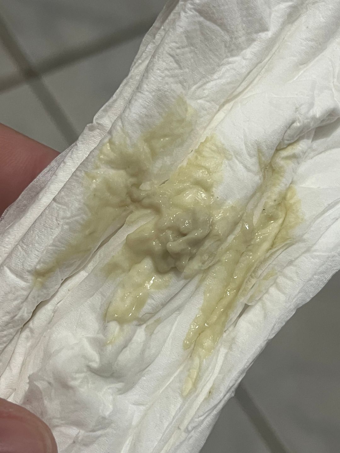 fotos de corrimento na gravidez