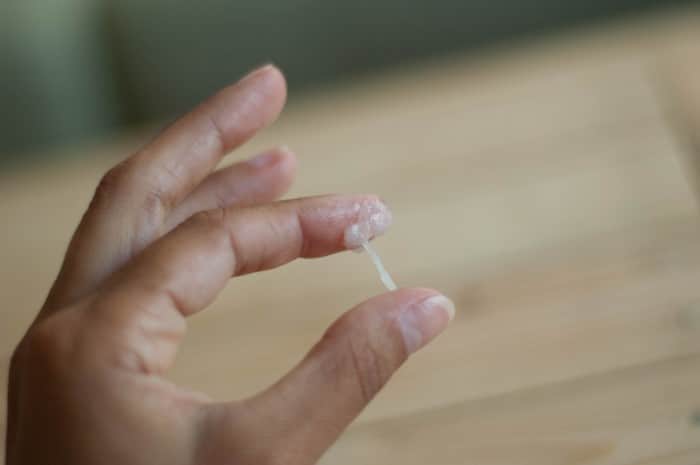 fotos de corrimento na gravidez