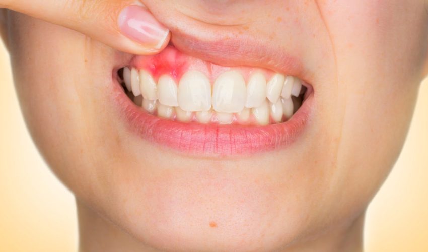 sintomas e cuidados especiais