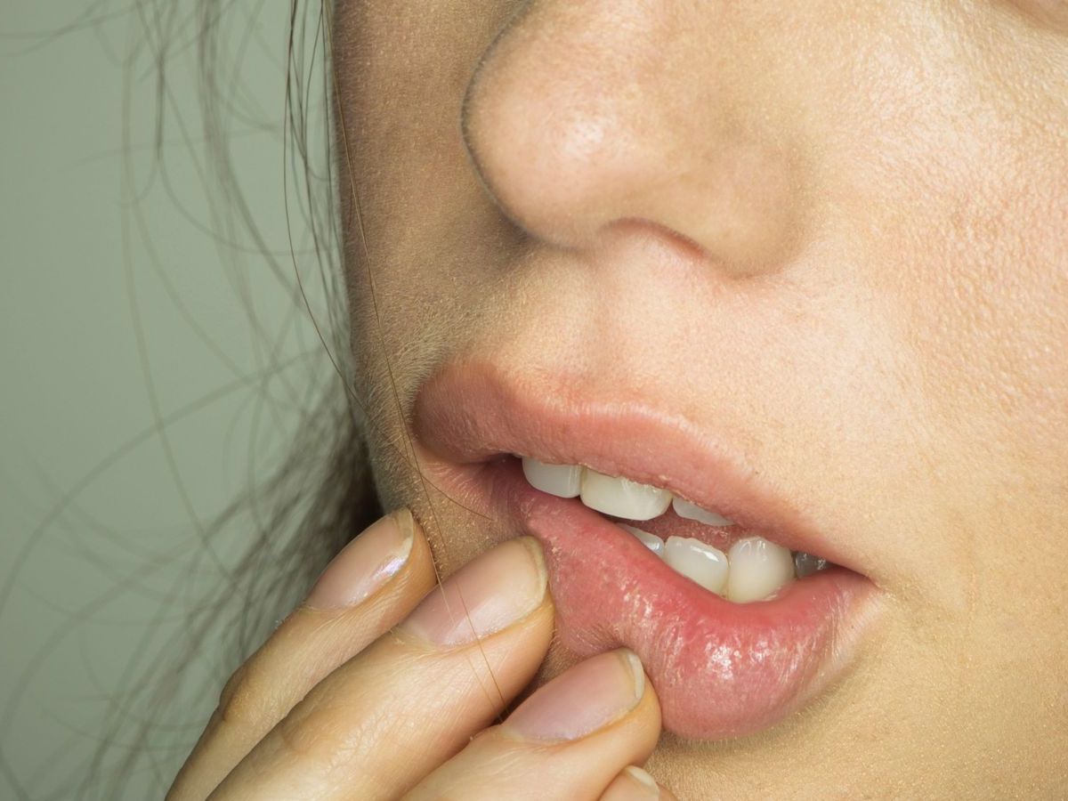 labios ressecados e rachados