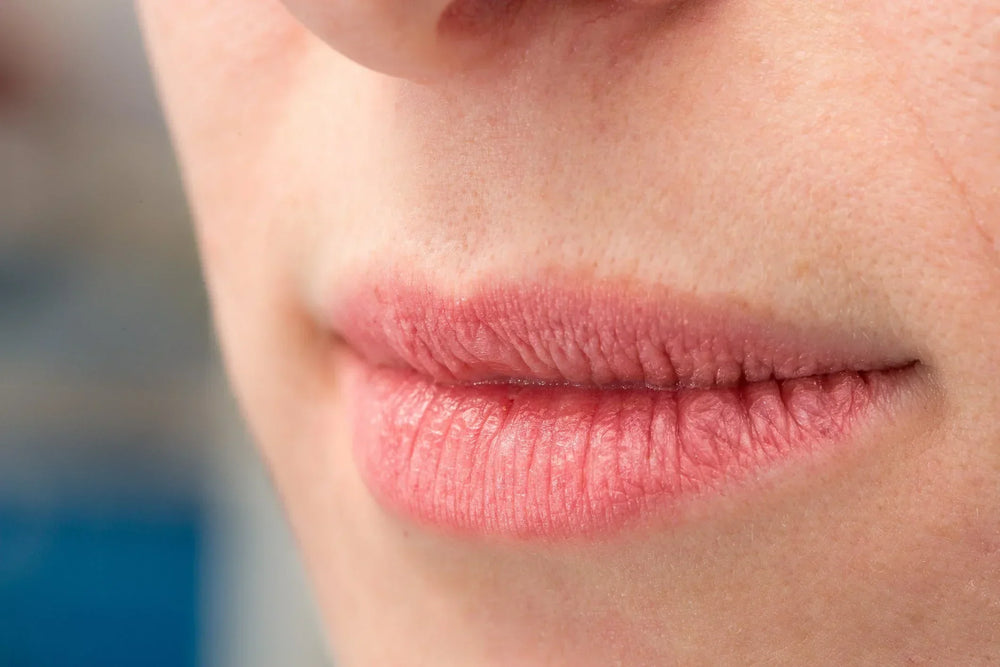 labios ressecados e rachados
