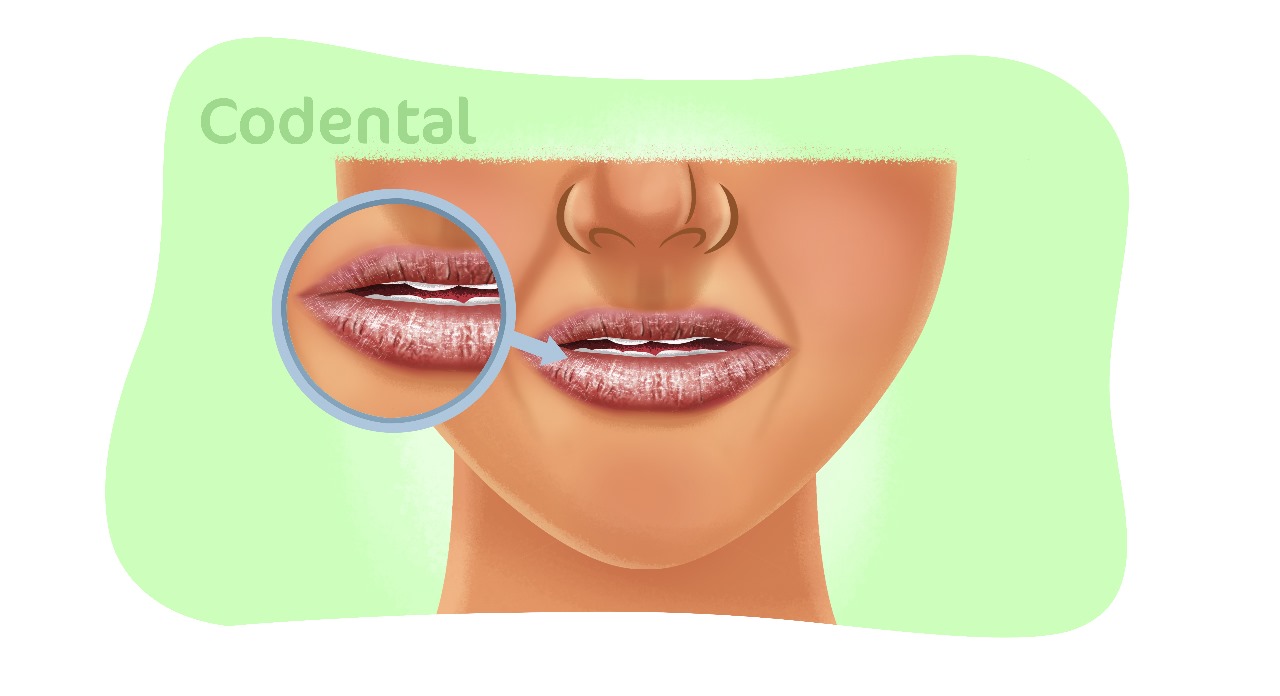 5 ideias de títulos:
1. Lábios Ressecados: Guia Completo de Causas e Tratamentos Eficazes
2. Os Melhores Ingredientes para Hidratar Lábios Rachados
3. Como Evitar Lamber os Lábios e Outros Hábitos Prejudiciais
4. Quando Procurar um Dermatologista para Problemas Labiais
5. Receitas Caseiras e Dicas Naturais para Lábios Saudáveis