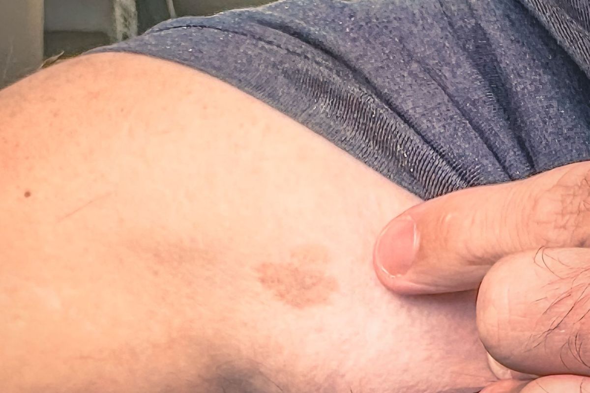 Mancha Mongólica: Mitos e Verdades