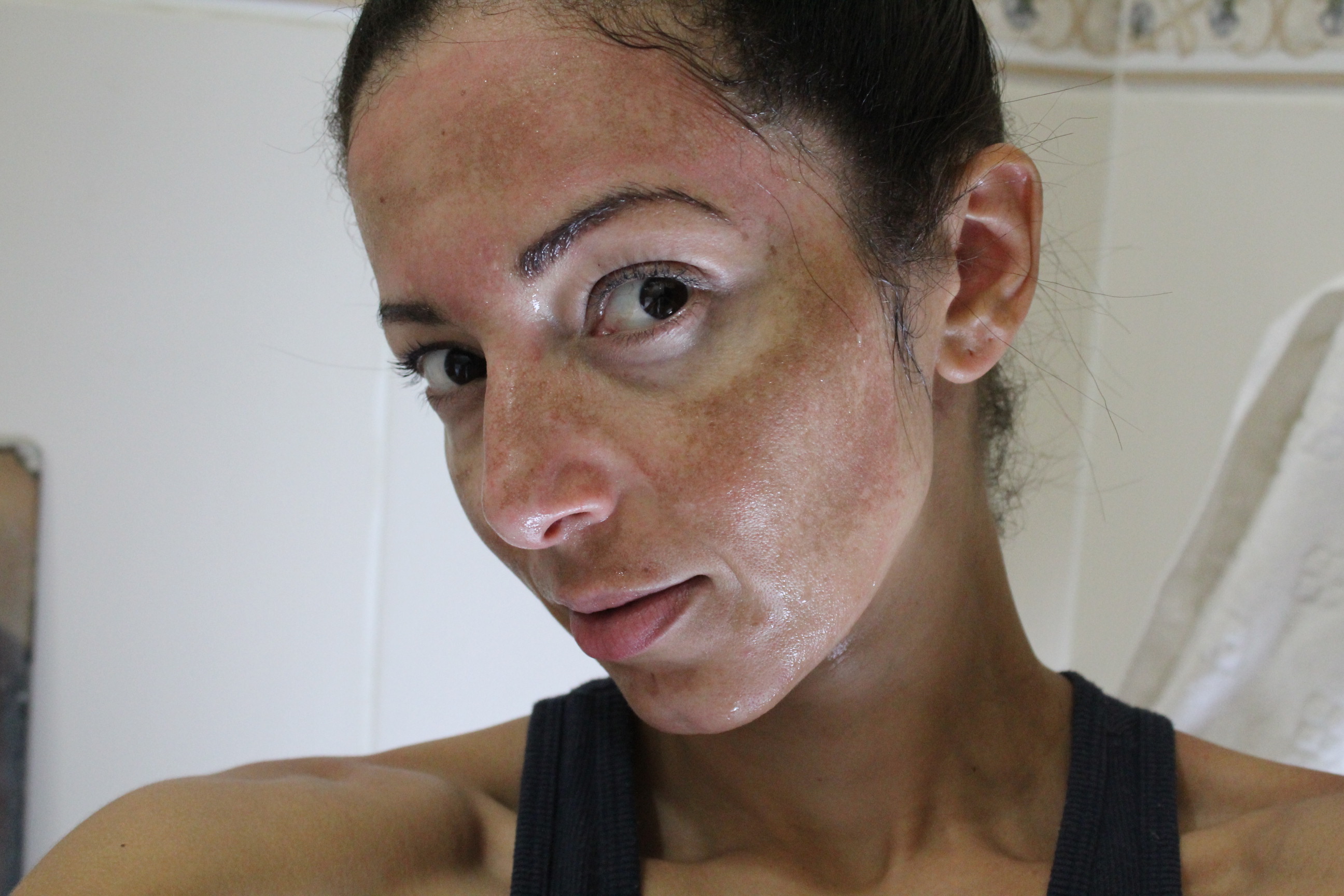 Como escolher o tom certo de corretivo para melasma e manchas