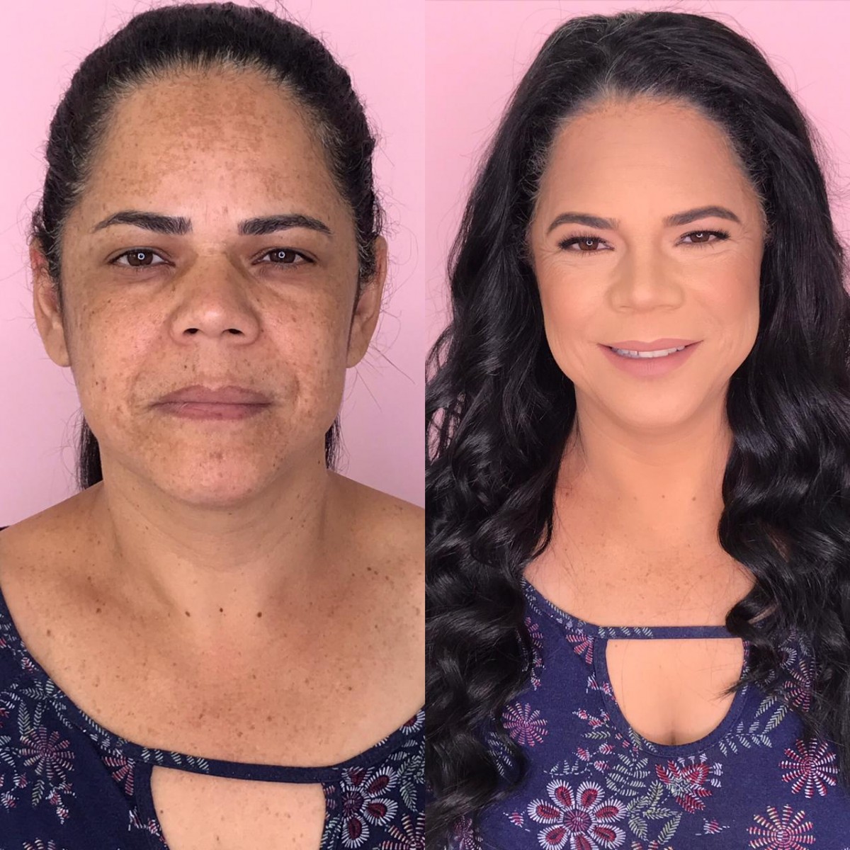 As melhores bases de alta cobertura para pele com melasma em 2024