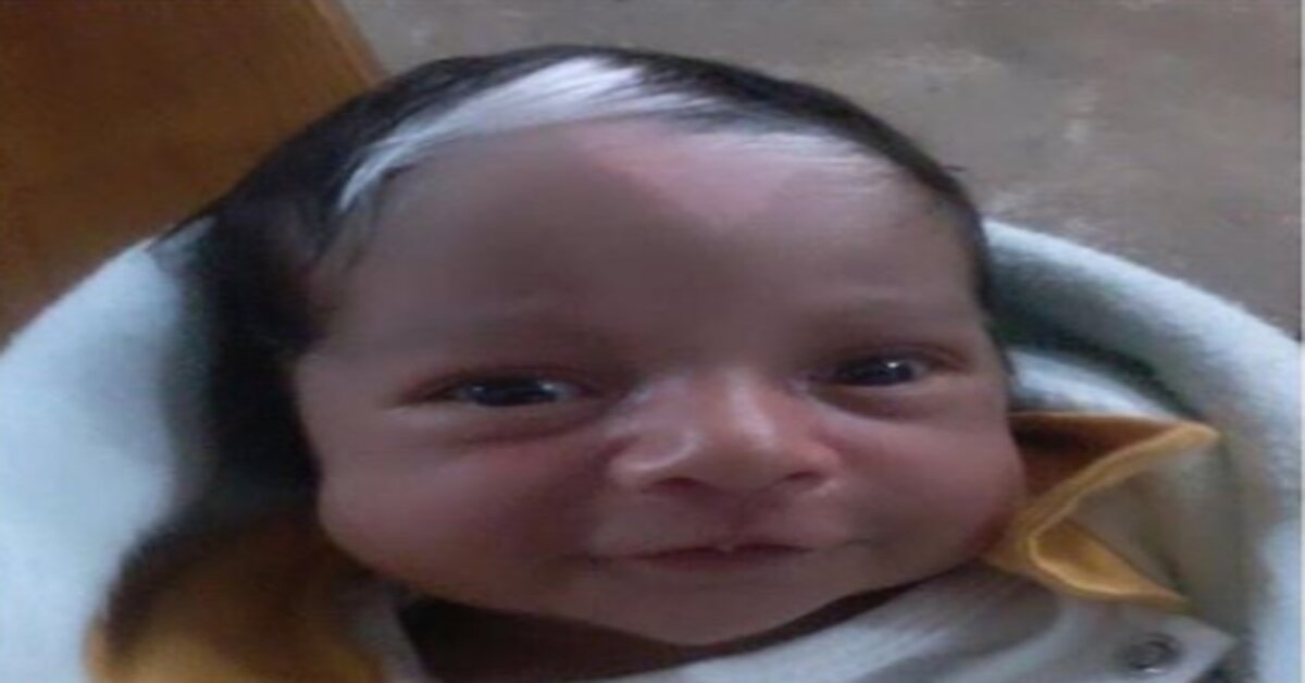 mecha branca no cabelo