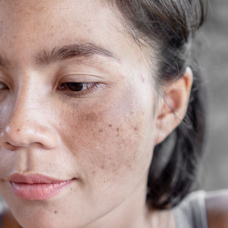 Guia completo de protetores solares seguros para gestantes