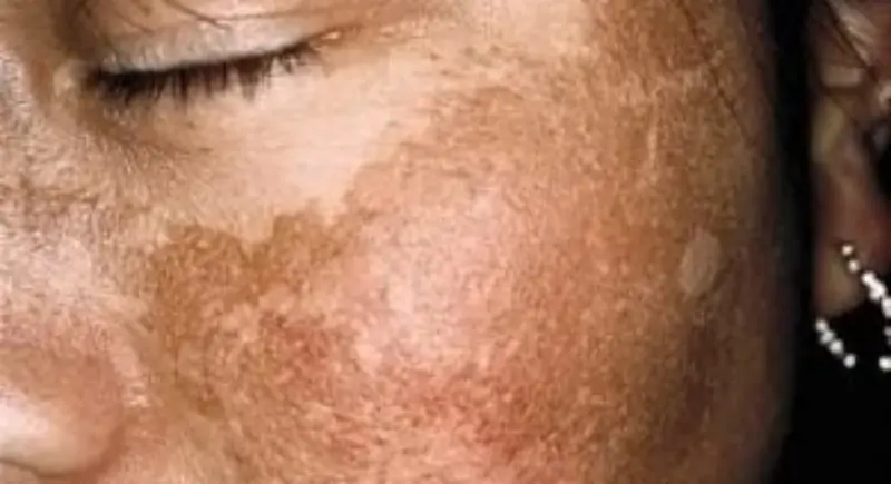 Guia completo de protetores solares seguros para gestantes