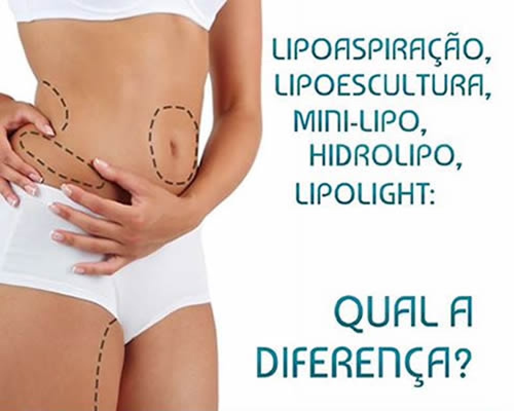 Quanto Custa uma Mini Lipo em 2026? Guia Completo de Preços e Fatores.