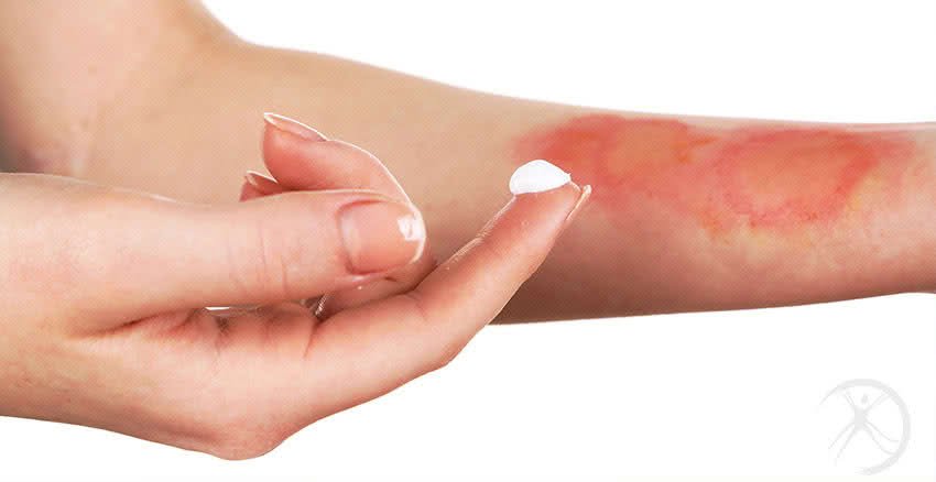 1. Como identificar o grau de uma queimadura.
2. Receitas caseiras para queimaduras: Mitos e Verdades.
3. A importância da hidratação na recuperação de queimaduras.
4. Quando procurar um médico para queimaduras.
5. Cuidados com queimaduras em crianças.