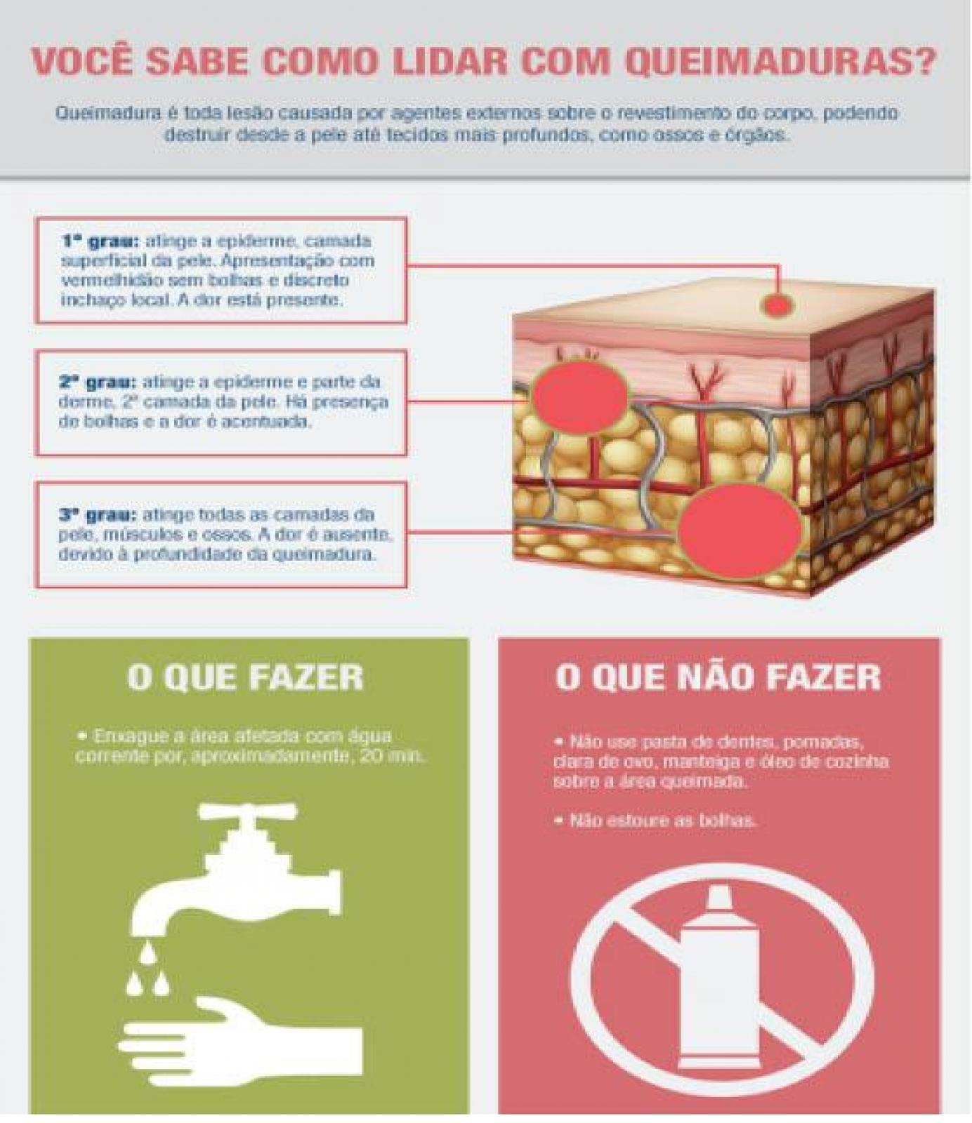1. Como identificar o grau de uma queimadura.
2. Receitas caseiras para queimaduras: Mitos e Verdades.
3. A importância da hidratação na recuperação de queimaduras.
4. Quando procurar um médico para queimaduras.
5. Cuidados com queimaduras em crianças.