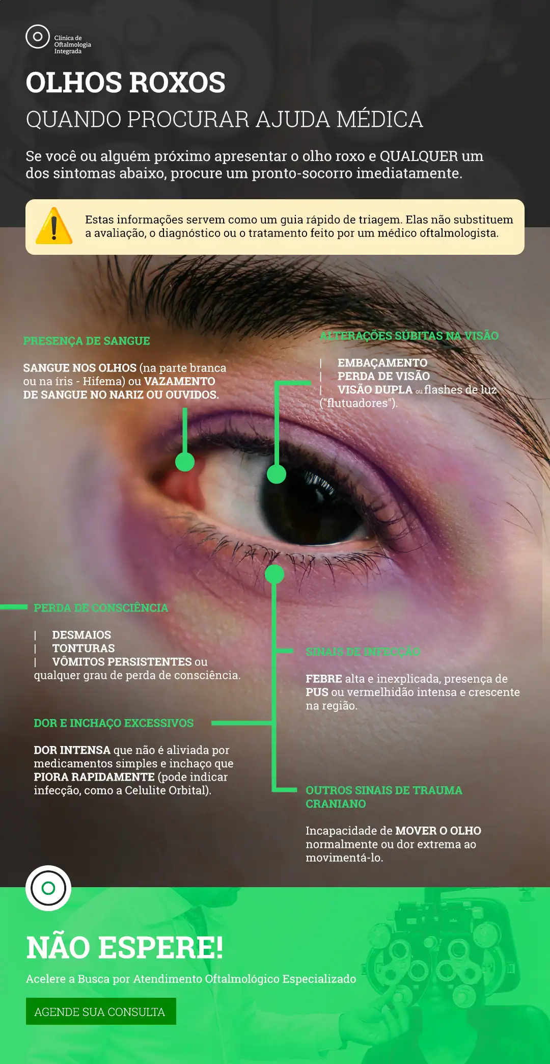 como aliviar inchaço nos olhos