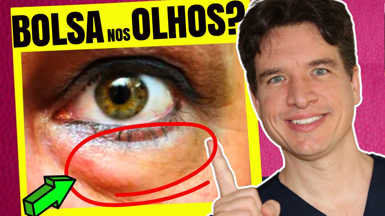 como aliviar inchaço nos olhos