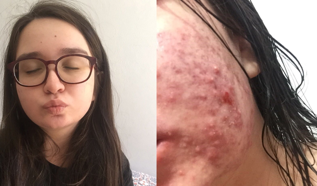 A Relação Entre Estresse