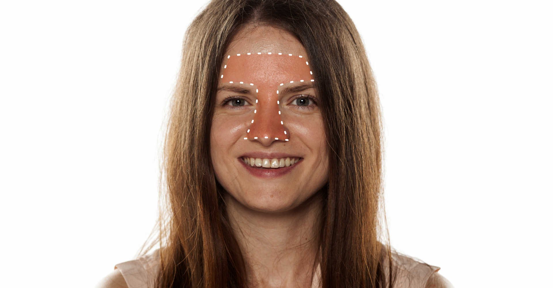 oleosidade na zona T