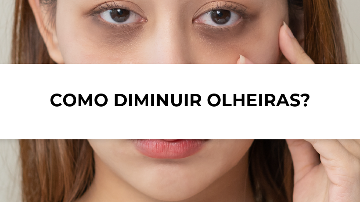 Quando Procurar um Médico para Tratar Olheiras e Bolsas nos Olhos