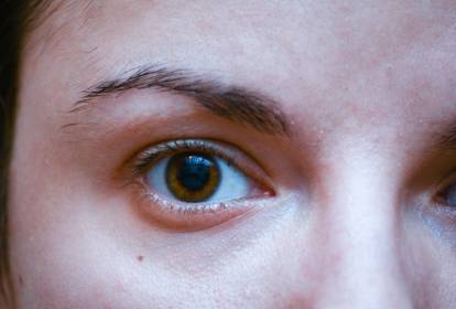 Guia Completo: Como Eliminar Olheiras e Bolsas nos Olhos