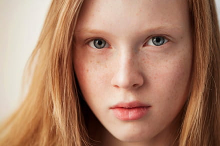 Os Melhores Produtos com Vitamina C para Peles com Sardas