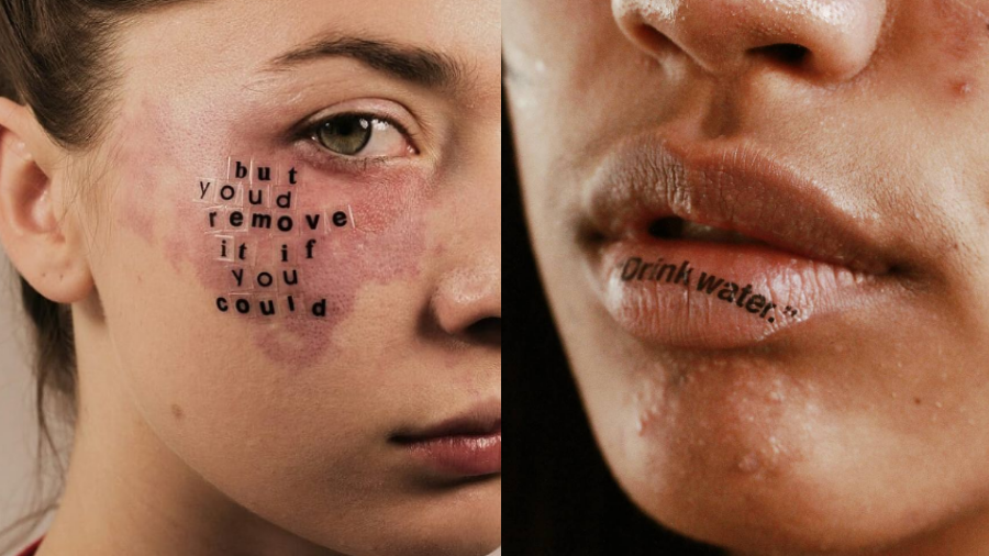 5 ideias de títulos:
1. Desvendando os Tipos de Pele: Guia Completo para Identificar e Tratar
2. A Rotina de Skincare Essencial: Limpeza