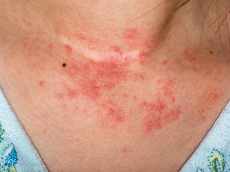 Causas e Tratamentos Eficazes