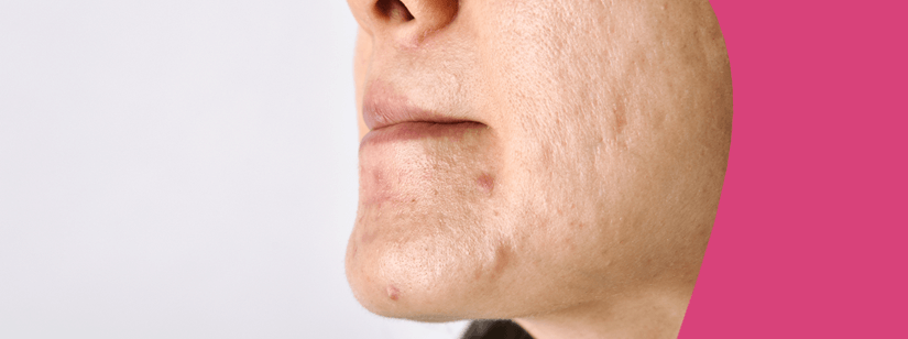 como devolver o viço à pele