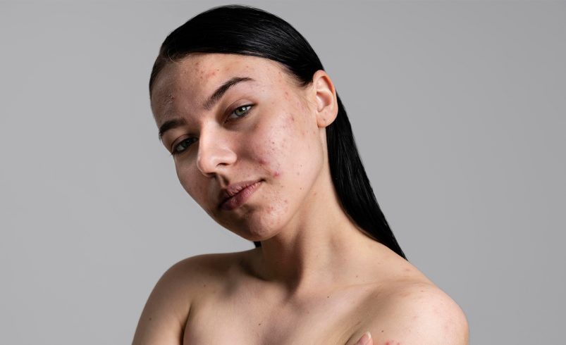 como devolver o viço à pele