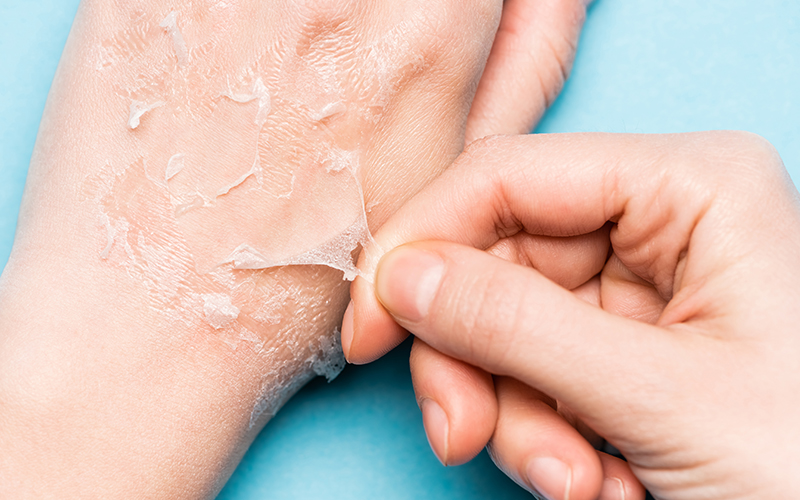 Os Melhores Hidratantes com Ceramidas para Pele Ressecada