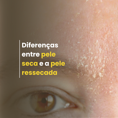 Pele Seca vs. Pele Ressecada: Entenda as Diferenças e Como Cuidar