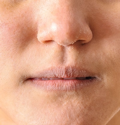 Guia Completo: Os Melhores Hidratantes para Pele Seca em 2024