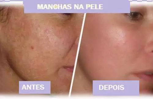 Como Esfoliar a Pele do Rosto Sem Danificar a Barreira Cutânea