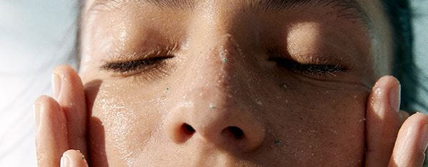 Os melhores ácidos para tratar cravos e filamentos sebáceos