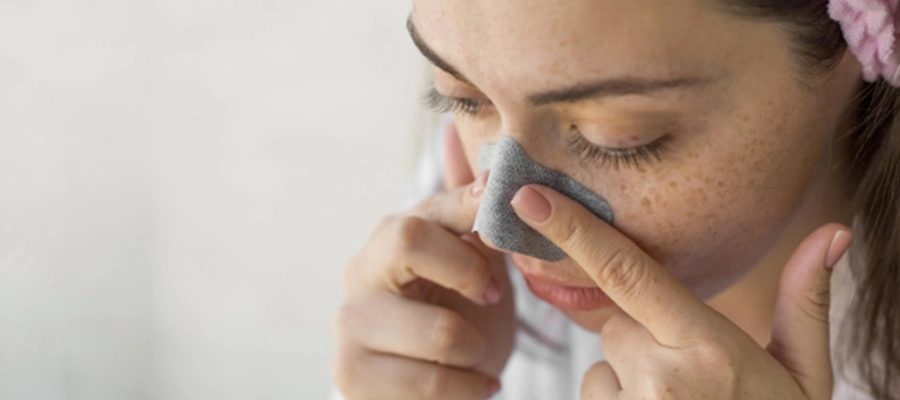 pontos pretos no nariz