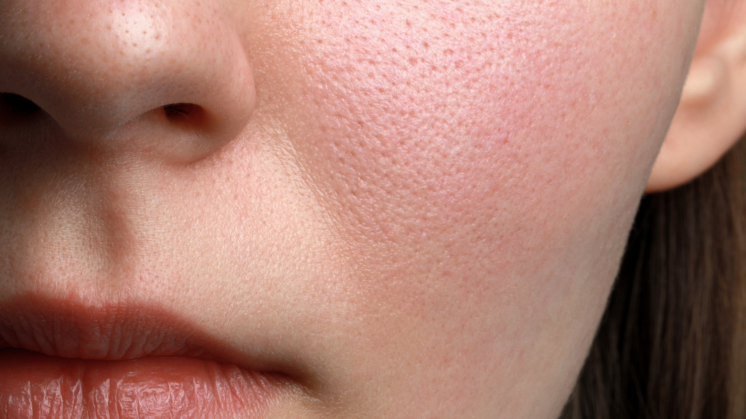 Guia Completo: Como Montar uma Rotina de Skincare para Poros Dilatados