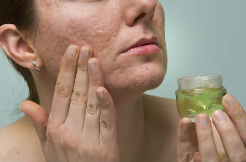 1. Babosa no Rosto: Mitos e Verdades sobre o Uso Diário
2. Como Preparar e Aplicar Babosa na Pele para Máximos Benefícios
3. Babosa para Pele Oleosa: Um Guia Completo
4. Os Perigos Ocultos do Uso Incorreto da Babosa no Rosto
5. Receitas Caseiras de Máscaras de Babosa para Cada Tipo de Pele