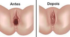 Harmonização Íntima Masculina: Procedimentos, Preços e Resultados em 2025