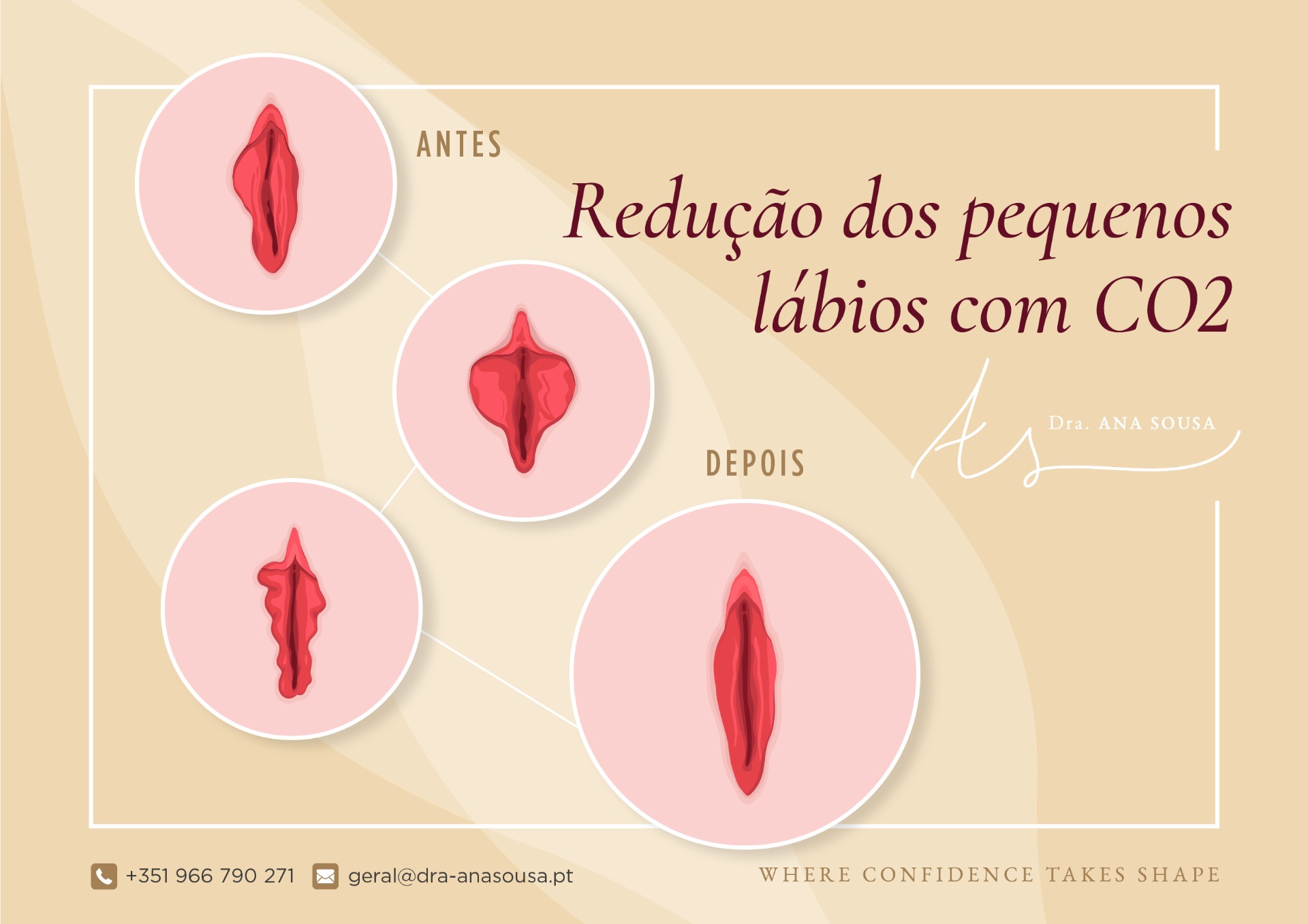 Harmonização Íntima Masculina: Procedimentos, Preços e Resultados em 2025