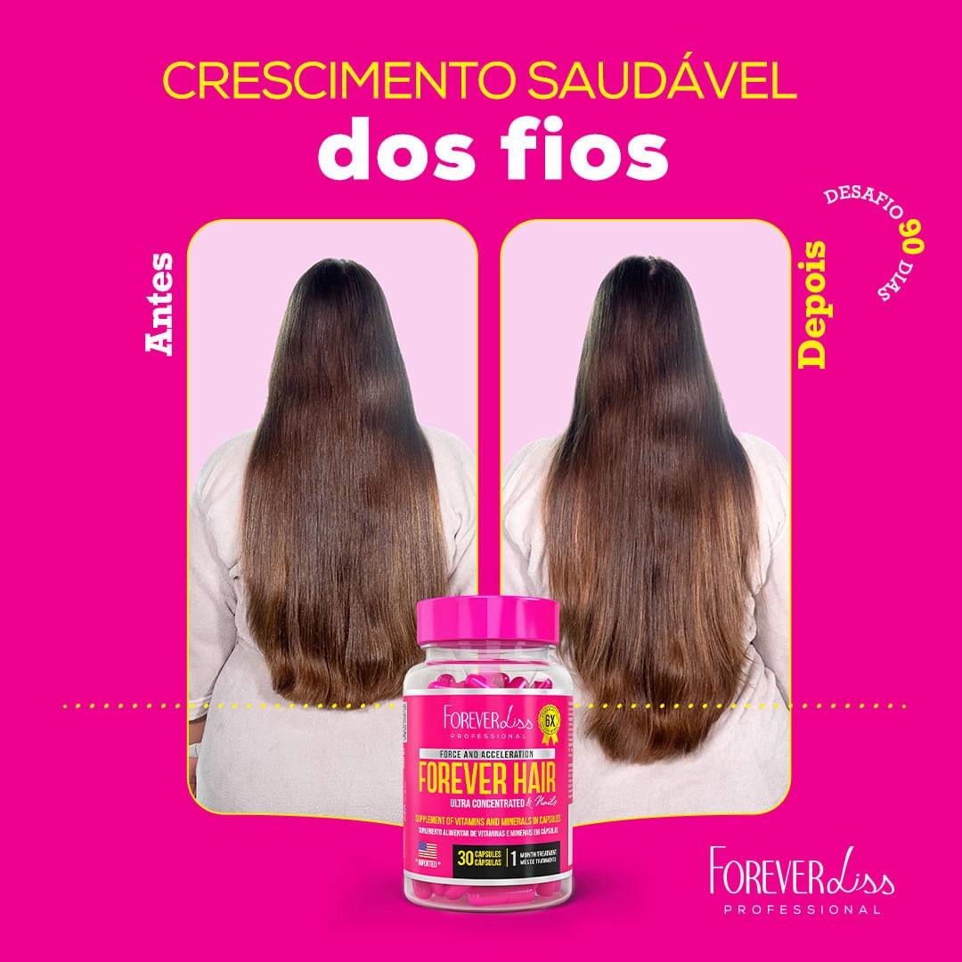 remedio para crescer cabelo