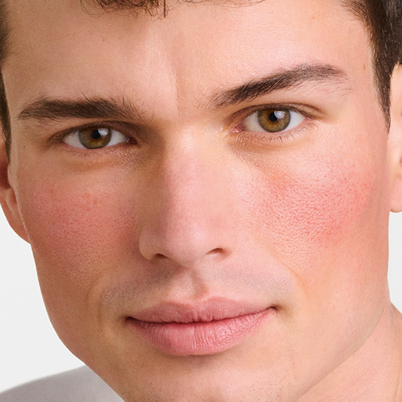 melhores protetores solares para rosácea