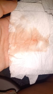 sangue no papel higiênico após relação