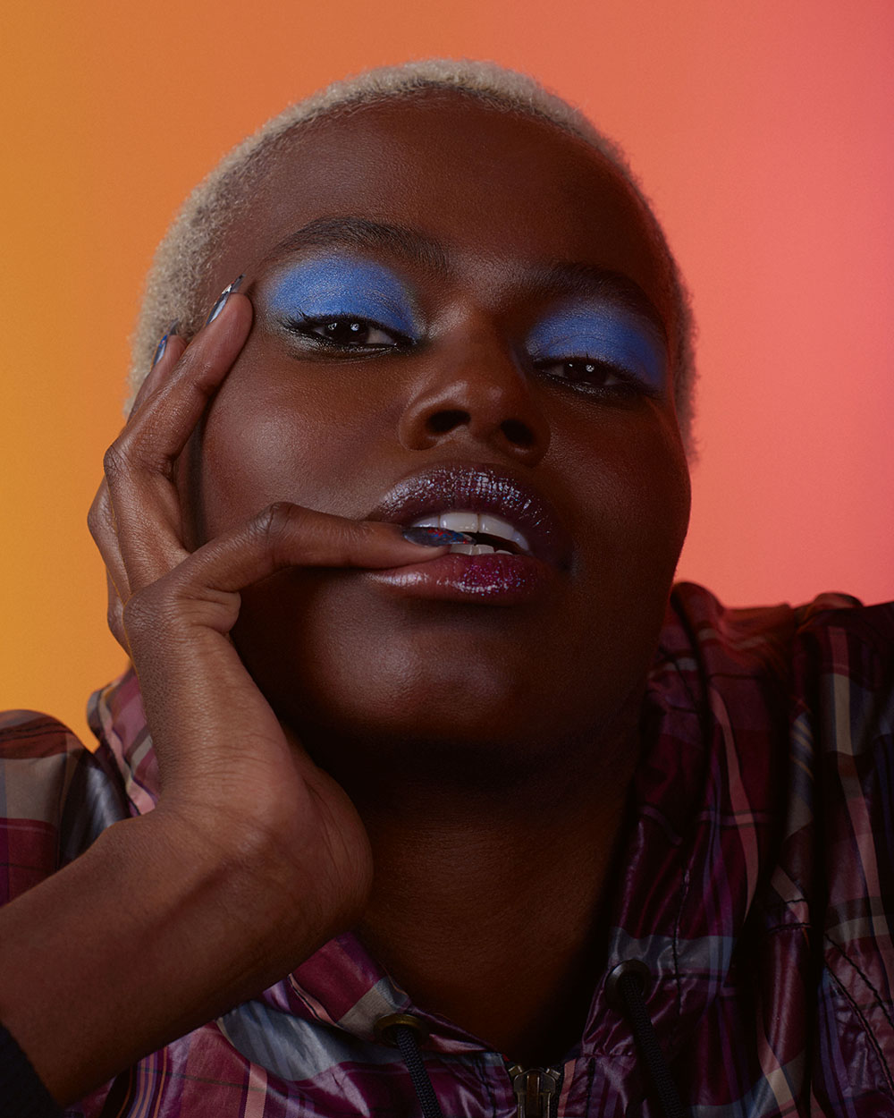 Tratamento Intensivo: Como Combater Acne e Oleosidade Excessiva