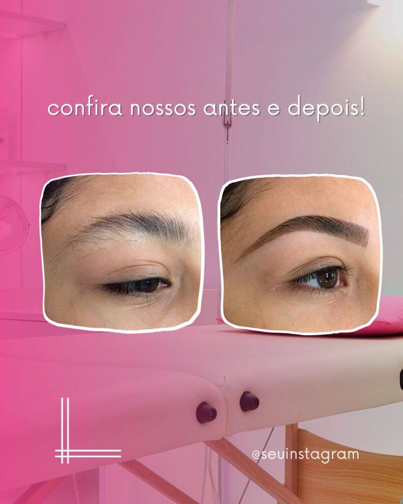 sobrancelha antes e depois