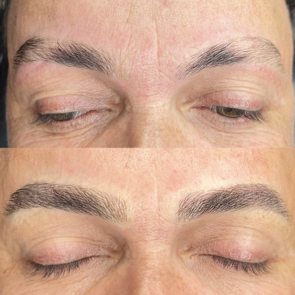 Micropigmentação vs. Nanopigmentação: Qual a Melhor para Você?