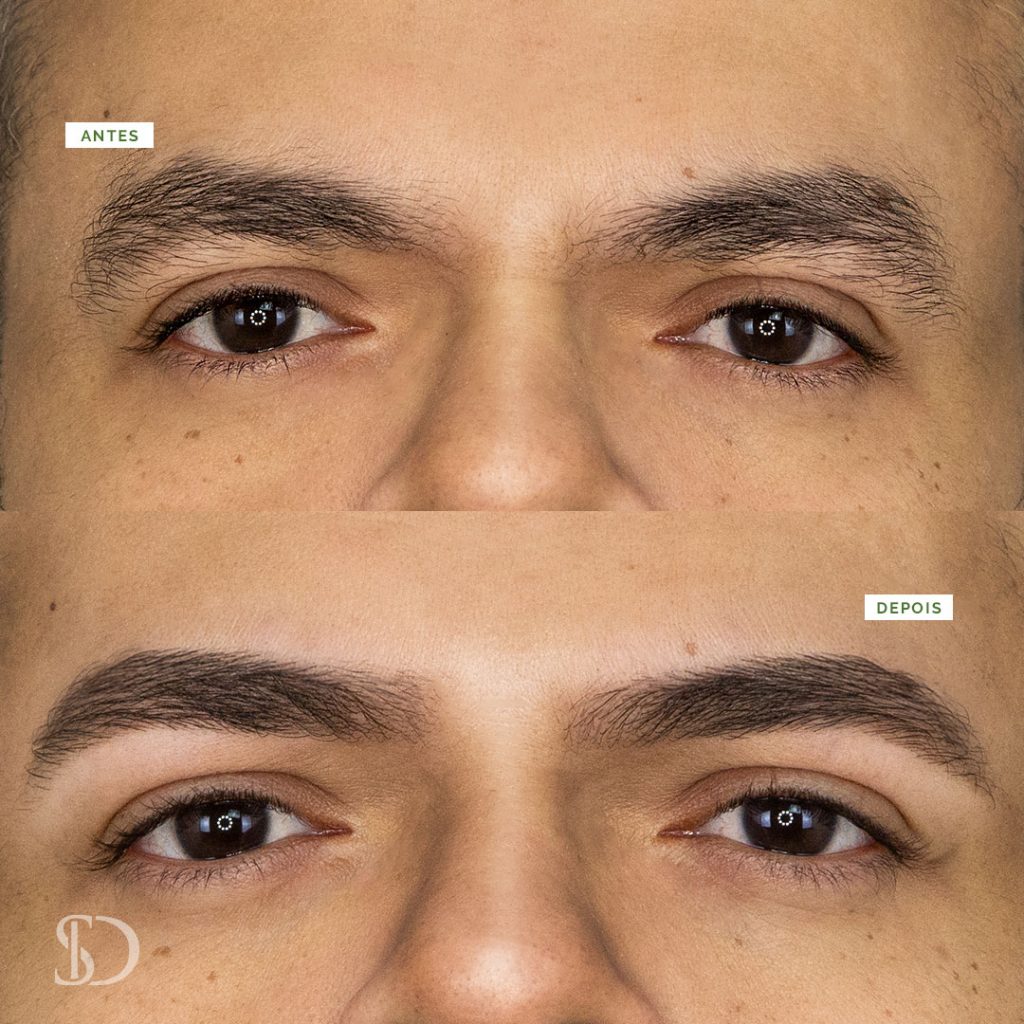 O Custo do Design de Sobrancelhas: O Que Esperar?