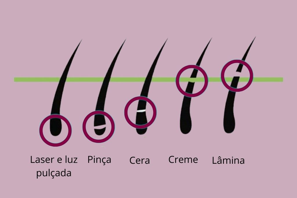 1. Depilação a Laser vs. Luz Pulsada: Qual a Melhor Opção para Você?
2. Guia Completo: Métodos de Depilação Caseiros e Profissionais
3. Depilação para Peles Sensíveis: Dicas e Recomendações
4. Cuidados Essenciais Antes e Depois da Depilação para Evitar Irritações
5. Depilação Definitiva: Mitos e Verdades sobre os Tratamentos a Laser e IPL